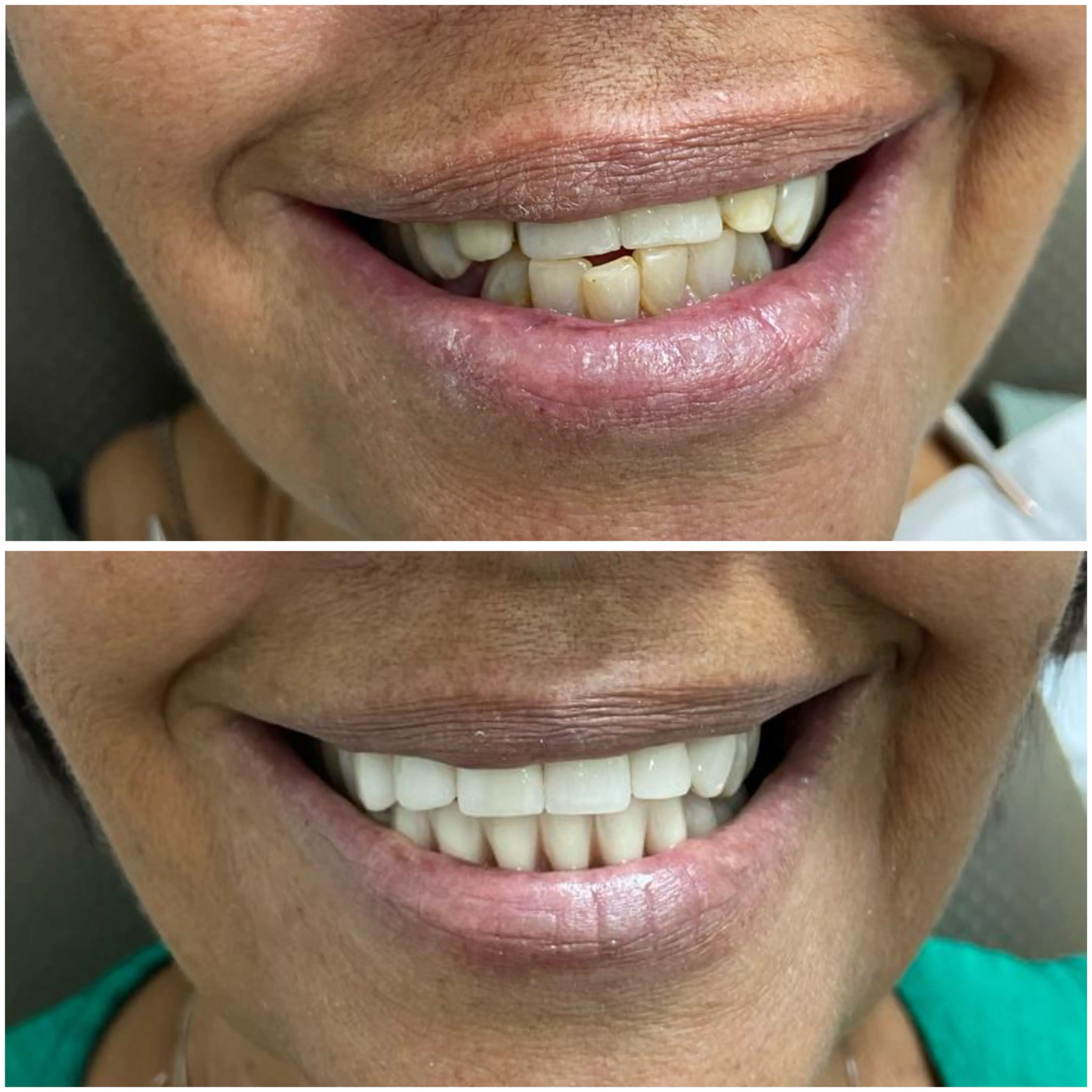 Antes e Depois 1