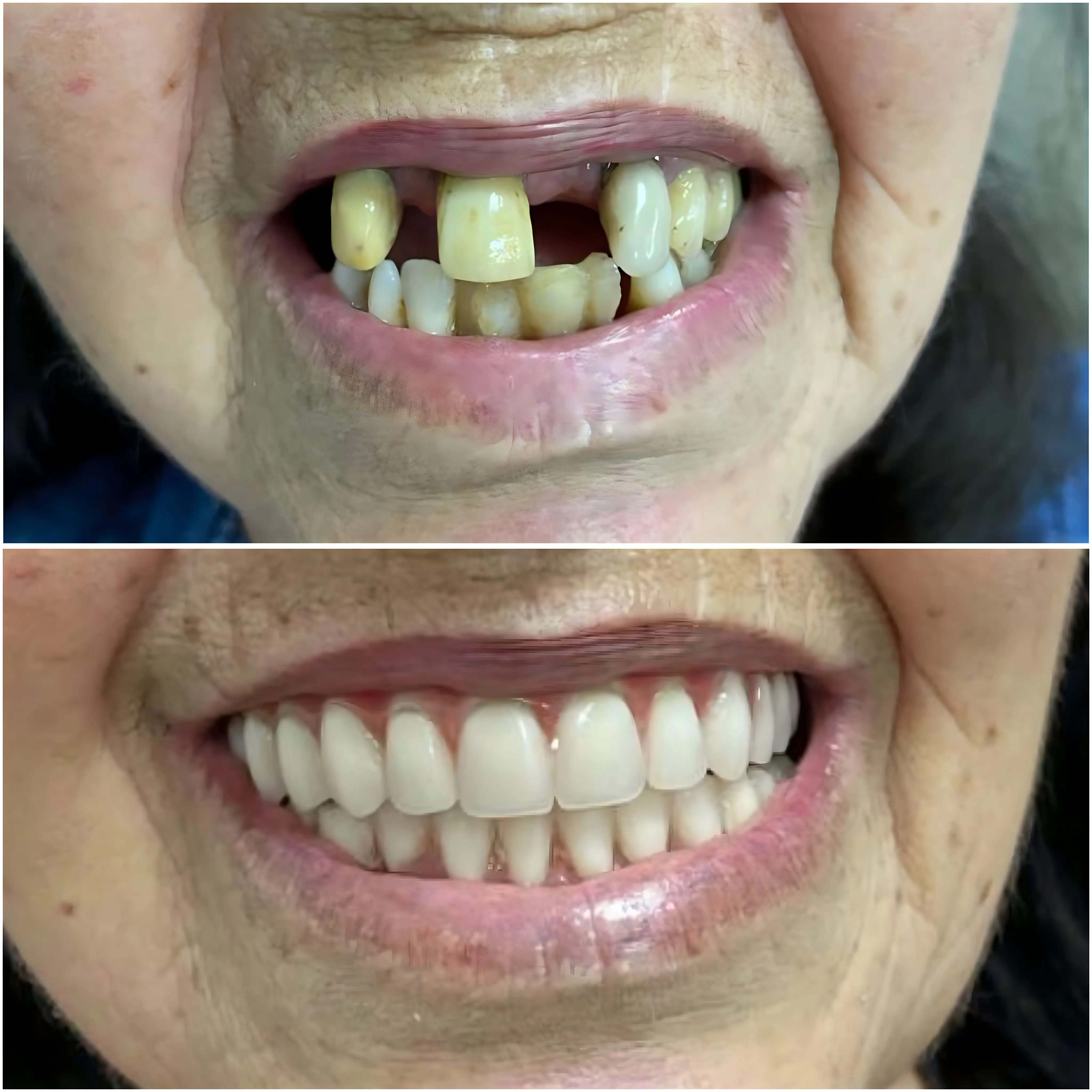 Antes e Depois 2